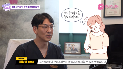 코 수술에 기증늑연골 괜찮을까? 기증늑연골의 효과 사진 4