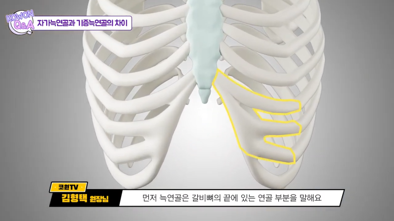 자가늑연골수술, 위험성이 높아 고민하시고 계시나요? 자가 늑연골에 대한 진실을 알려드립니다! 사진 6