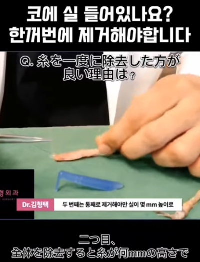 하이코, 베이코, 미스코 시술 후 코실제거, 한 번에 해야 합니다! 수술 사례보고 전후 비교해 봅시다. 사진 6