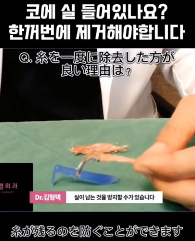 하이코, 베이코, 미스코 시술 후 코실제거, 한 번에 해야 합니다! 수술 사례보고 전후 비교해 봅시다.