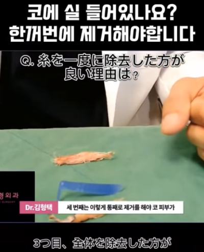 하이코, 베이코, 미스코 시술 후 코실제거, 한 번에 해야 합니다! 수술 사례보고 전후 비교해 봅시다. 사진 10