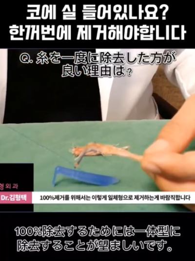 하이코, 베이코, 미스코 시술 후 코실제거, 한 번에 해야 합니다! 수술 사례보고 전후 비교해 봅시다. 사진 3