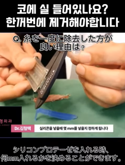 하이코, 베이코, 미스코 시술 후 코실제거, 한 번에 해야 합니다! 수술 사례보고 전후 비교해 봅시다. 사진 7