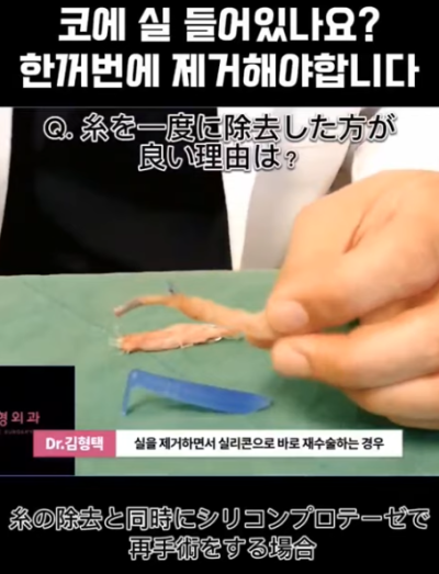 하이코, 베이코, 미스코 시술 후 코실제거, 한 번에 해야 합니다! 수술 사례보고 전후 비교해 봅시다. 사진 8