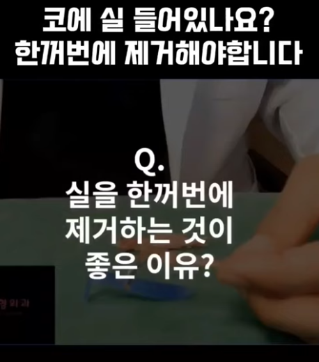 하이코, 베이코, 미스코 시술 후 코실제거, 한 번에 해야 합니다! 수술 사례보고 전후 비교해 봅시다.