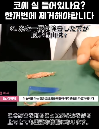 하이코, 베이코, 미스코 시술 후 코실제거, 한 번에 해야 합니다! 수술 사례보고 전후 비교해 봅시다. 사진 9