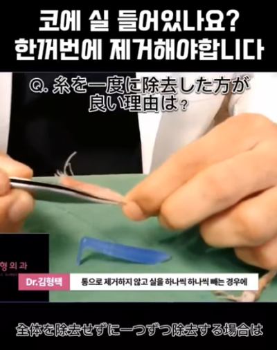 하이코, 베이코, 미스코 시술 후 코실제거, 한 번에 해야 합니다! 수술 사례보고 전후 비교해 봅시다. 사진 4