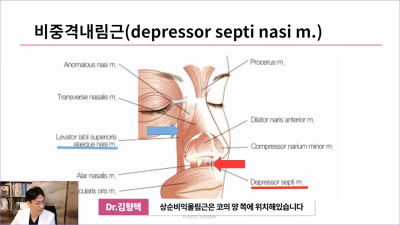 화살코 만드는 근육?! 비중격내림근과 상순비익올림근 절단해야 화살코 해결할 수 있습니다. 사진 8
