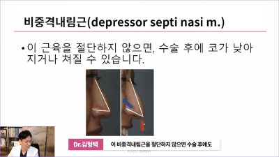 화살코 만드는 근육?! 비중격내림근과 상순비익올림근 절단해야 화살코 해결할 수 있습니다. 사진 9