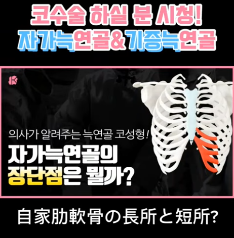 코 재수술에 많이 사용하는 자가늑연골에 대한 모든 것! 장단점은?