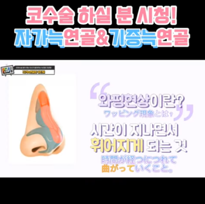 코 재수술에 많이 사용하는 자가늑연골에 대한 모든 것! 장단점은? 사진 16