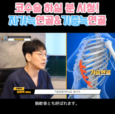 코 재수술에 많이 사용하는 자가늑연골에 대한 모든 것! 장단점은? 사진 10