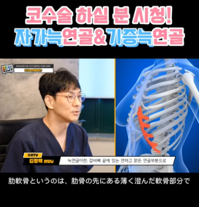 코 재수술에 많이 사용하는 자가늑연골에 대한 모든 것! 장단점은? 사진 9