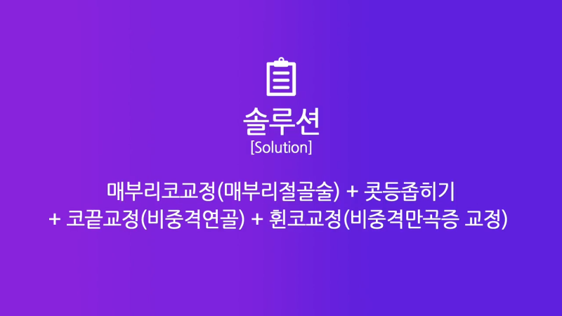남자매부리코, 휜코교정을 통해 날렵한 코로 개선했습니다. 사진 4