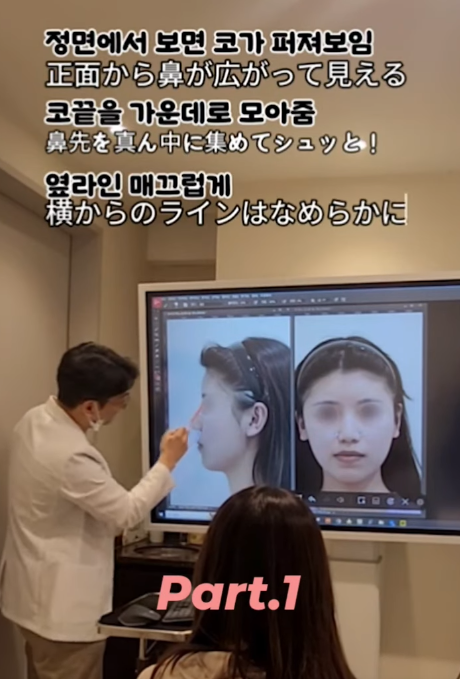 매부리코, 퍼진코 비순각 코수술 후 매끄러워진 콧대 라인!