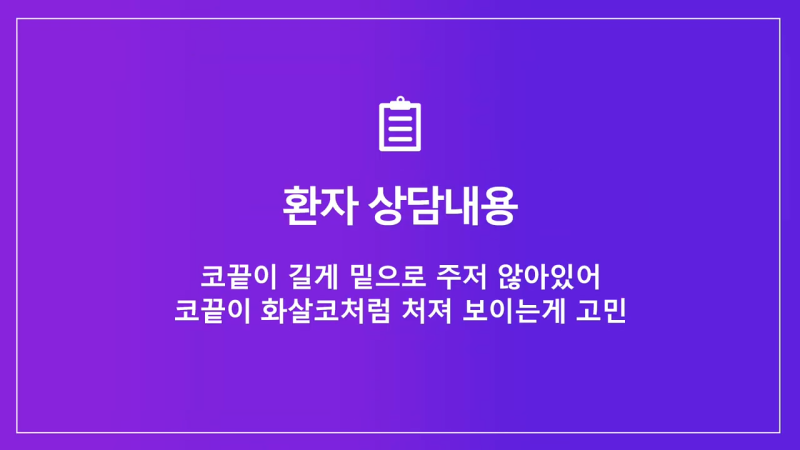 코끝 처진코/화살코 개선을 위해 코끝내림근 제거한 사례