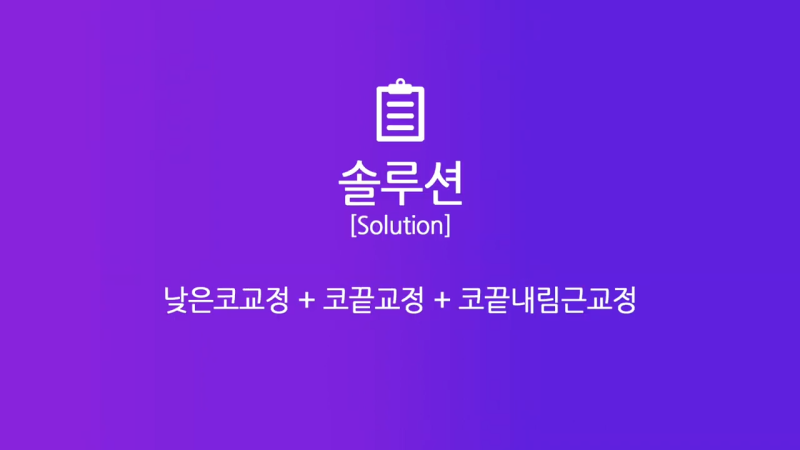 코끝 처진코/화살코 개선을 위해 코끝내림근 제거한 사례 사진 4