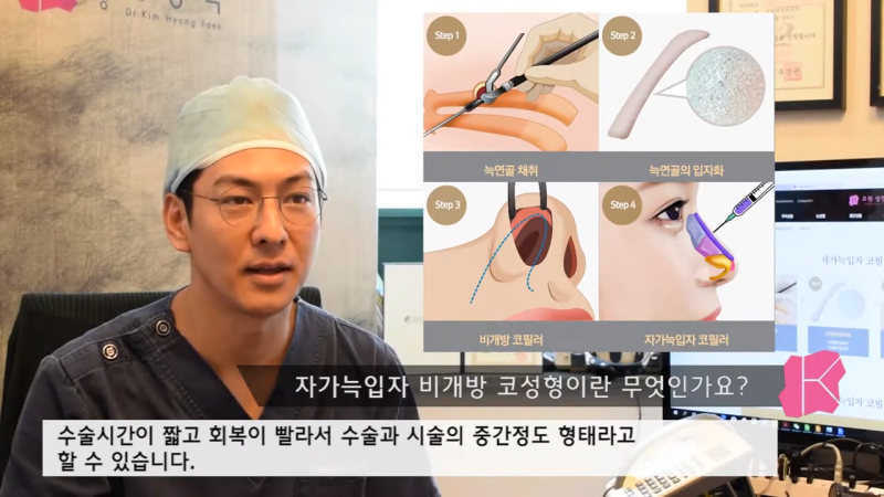 자가늑입자 비개방코성형, 수술 방법과 추천 대상은? 사진 4