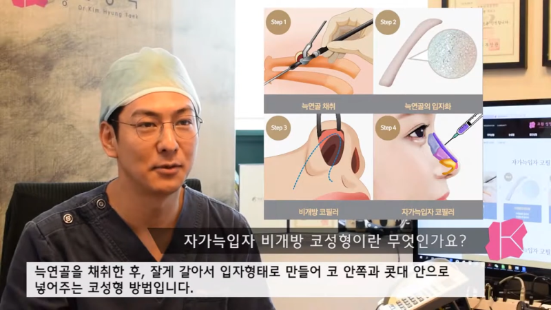 자가늑입자 비개방코성형, 수술 방법과 추천 대상은? 사진 3