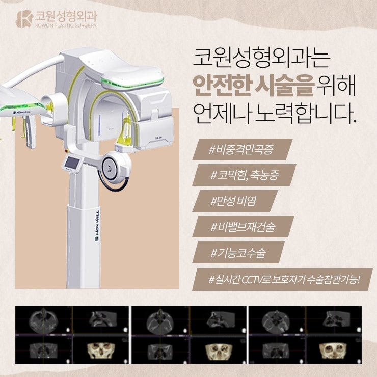 복코수술 콧볼축소, 콧날개자르기가 필요 없는 코 진단하기 사진 3