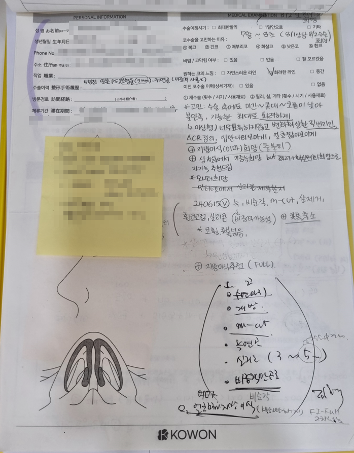 코수술로 ‘중안면 함몰 개선’ 가능 – 코원성형외과 - 사진 4