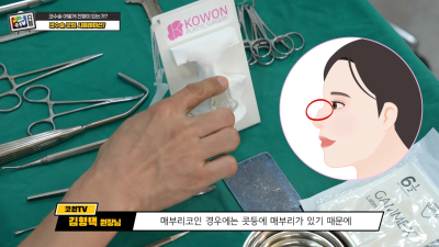 코수술 관련 Q&A [수술 도구/매부리코,복코/재수술] 사진 8