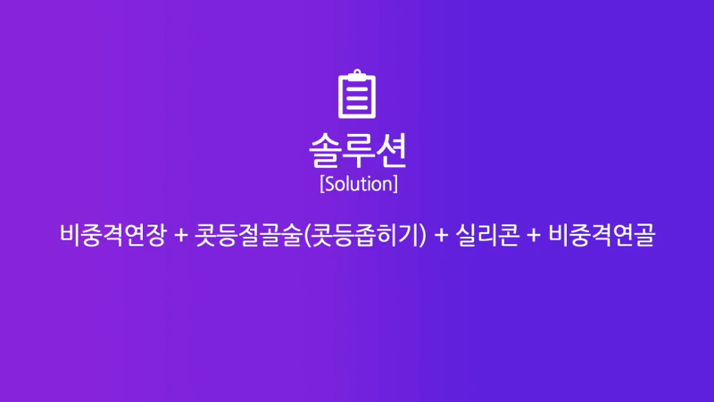 여자낮은코, 오똑한 코로 개선 성공한 사례 사진 3