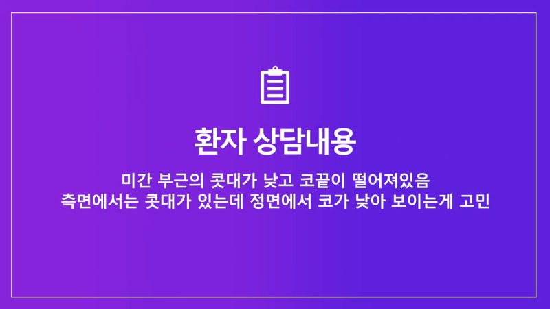 여자낮은코, 오똑한 코로 개선 성공한 사례