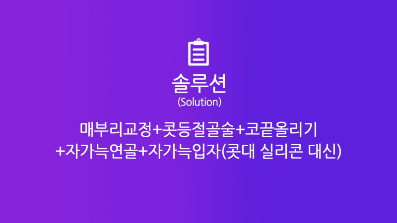 코재건수술 후 만족스럽지 못해 자가늑입자로 재수술한 사례 사진 3