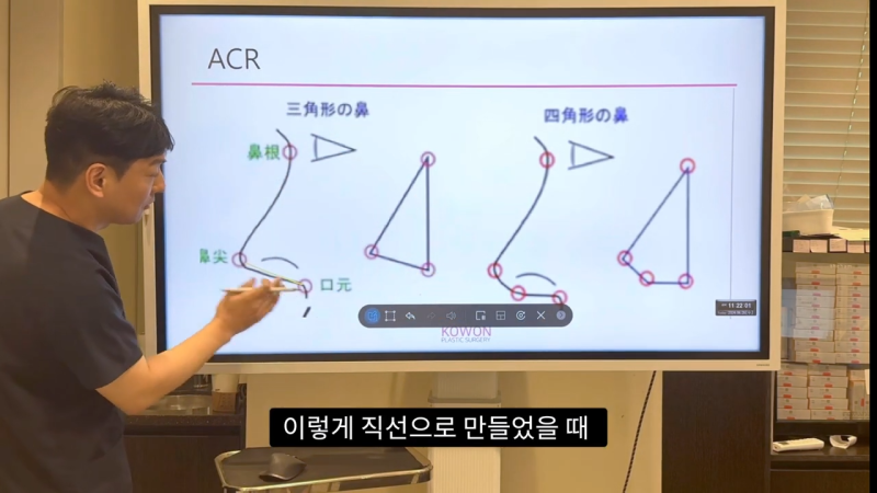 코 수술로 돌출입수술 효과를 얻을 수 있습니다! - 1편 사진 12