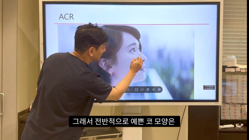 코 수술로 돌출입수술 효과를 얻을 수 있습니다! - 1편 사진 13
