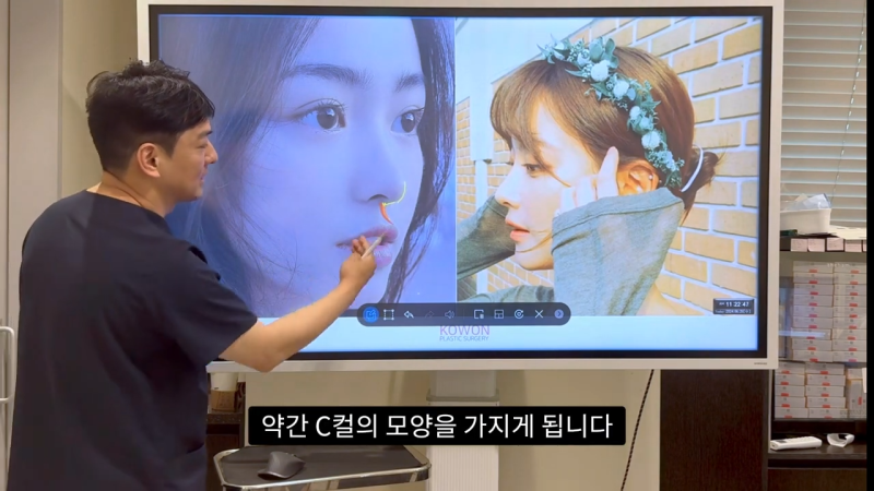 코 수술로 돌출입수술 효과를 얻을 수 있습니다! - 1편 사진 18