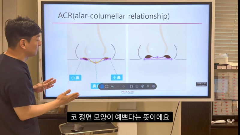 코 수술로 돌출입수술 효과를 얻을 수 있습니다! - 1편 사진 8