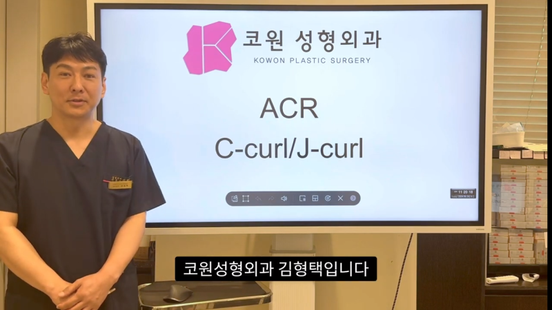 코 수술로 돌출입수술 효과를 얻을 수 있습니다! - 1편