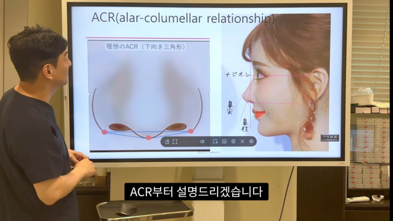 코 수술로 돌출입수술 효과를 얻을 수 있습니다! - 1편 사진 3