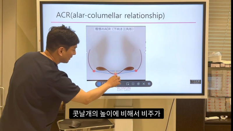 코 수술로 돌출입수술 효과를 얻을 수 있습니다! - 1편 사진 6