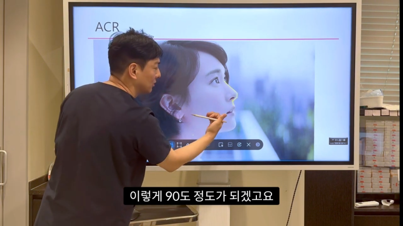 코 수술로 돌출입수술 효과를 얻을 수 있습니다! - 1편 사진 16