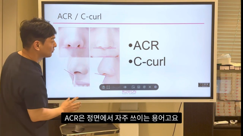코 수술로 돌출입수술 효과를 얻을 수 있습니다! - 1편