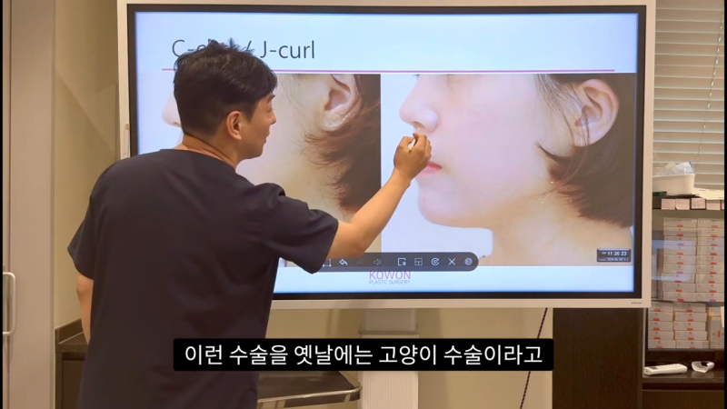 코 수술로 돌출입교정효과를 얻을 수 있습니다! - 2편 사진 13