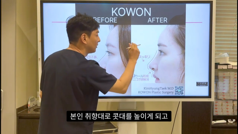 코 수술로 돌출입교정효과를 얻을 수 있습니다! - 2편 사진 19