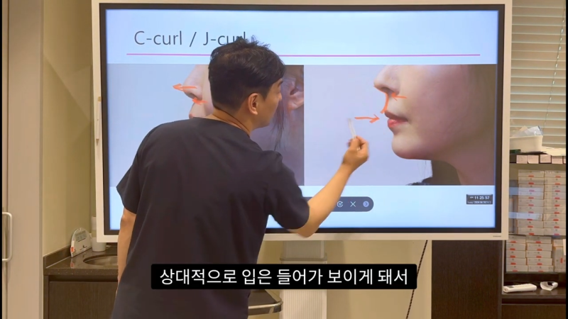 코 수술로 돌출입교정효과를 얻을 수 있습니다! - 2편 사진 10