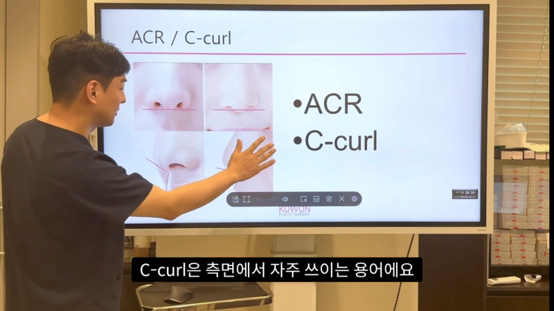 코 수술로 돌출입교정효과를 얻을 수 있습니다! - 2편