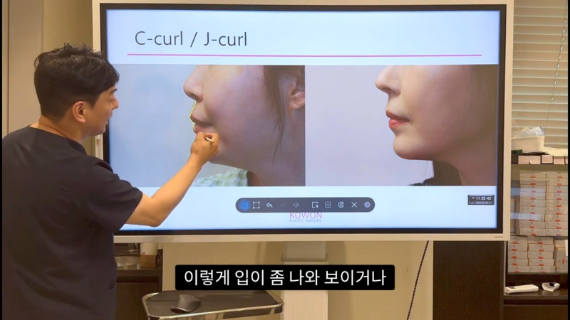 코 수술로 돌출입교정효과를 얻을 수 있습니다! - 2편 사진 7