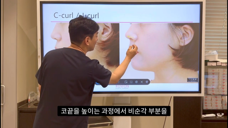 코 수술로 돌출입교정효과를 얻을 수 있습니다! - 2편 사진 16