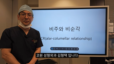 돌출입코성형, 비순각 각도와 비주내리기 수술의 관계성 - 1편