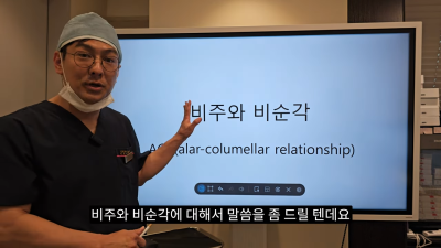 돌출입코성형, 비순각 각도와 비주내리기 수술의 관계성 - 1편