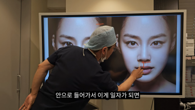 돌출입코성형, 비순각 각도와 비주내리기 수술의 관계성 - 1편 사진 17