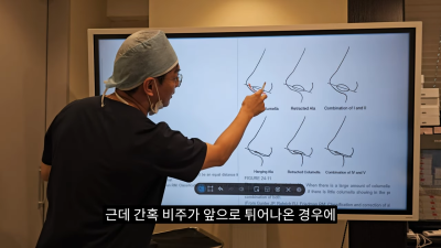 돌출입코성형, 비순각 각도와 비주내리기 수술의 관계성 - 1편 사진 7