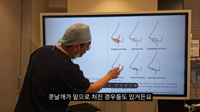 돌출입코성형, 비순각 각도와 비주내리기 수술의 관계성 - 1편 사진 8