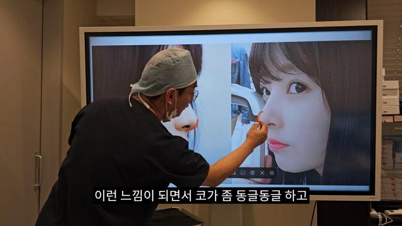 사각코성형 방법으로 돌출입개선효과와 자연스러운코를 만들어 보세요. 사진 18